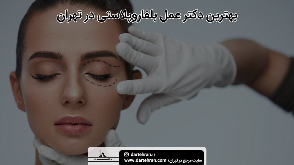 بهترین دکتر عمل بلفاروپلاستی در تهران