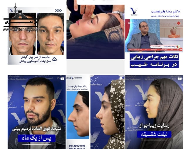 اینستاگرام دکتر رضا وقردوست