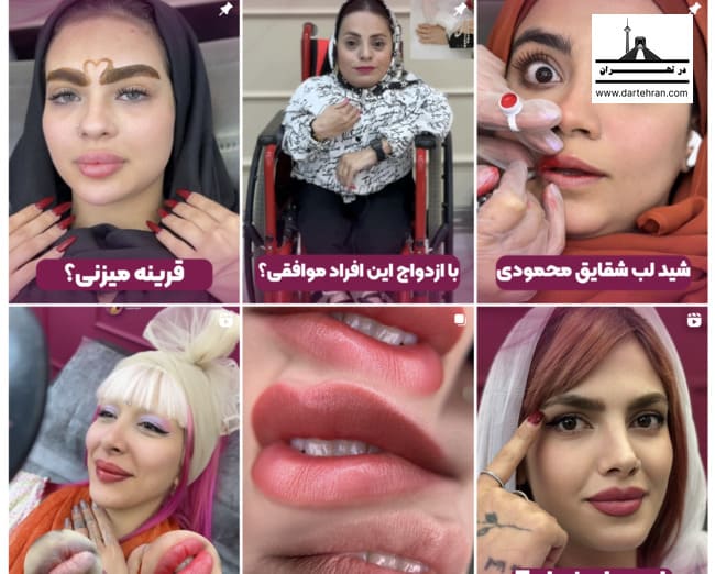 اینستاگرام مرکز فیبروز ابرو مریم حمزه ای