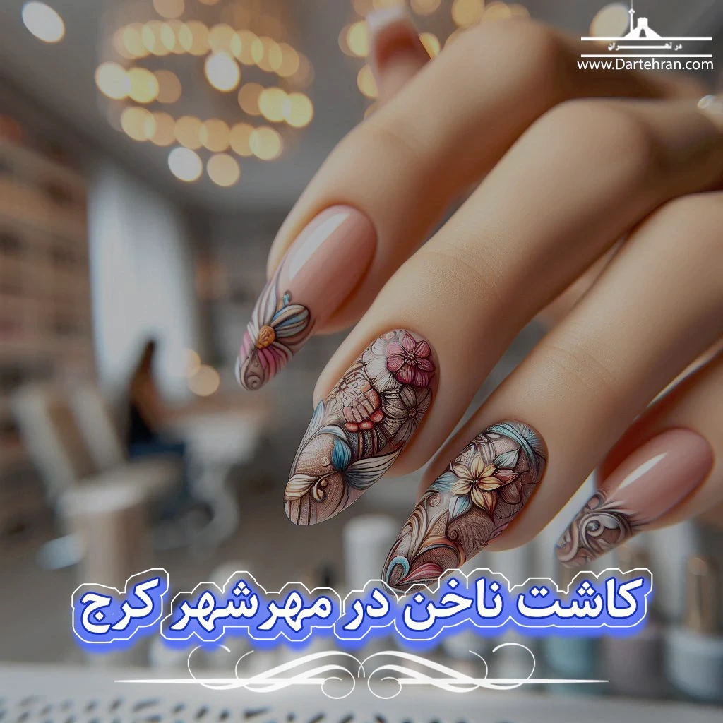 کاشت ناخن در مهرشهر کرج