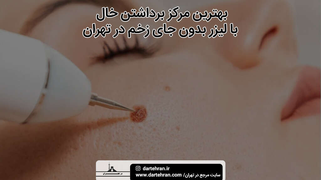 7تا بهترین مرکز برداشتن خال در تهران (اینستا + تلفن) با لیزر
