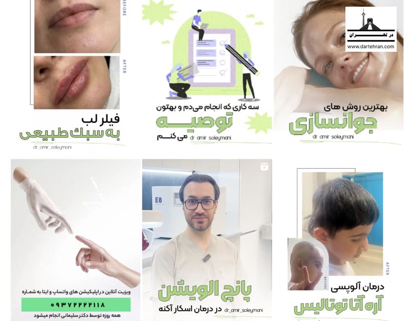 اینستاگرام مرکز برداشتن خال با لیزر بدون جای زخم دکتر امیر سلیمانی