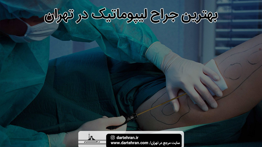 بهترین جراح لیپوماتیک تهران