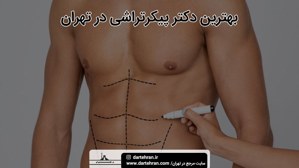 بهترین دکتر پیکر تراشی در تهران