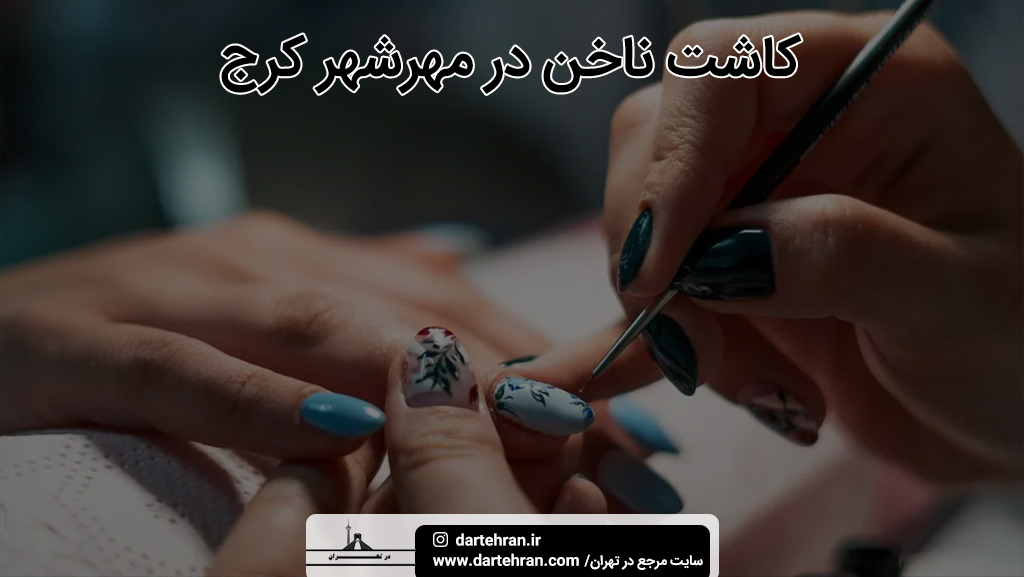 بهترین کاشت ناخن در مهرشهر کرج
