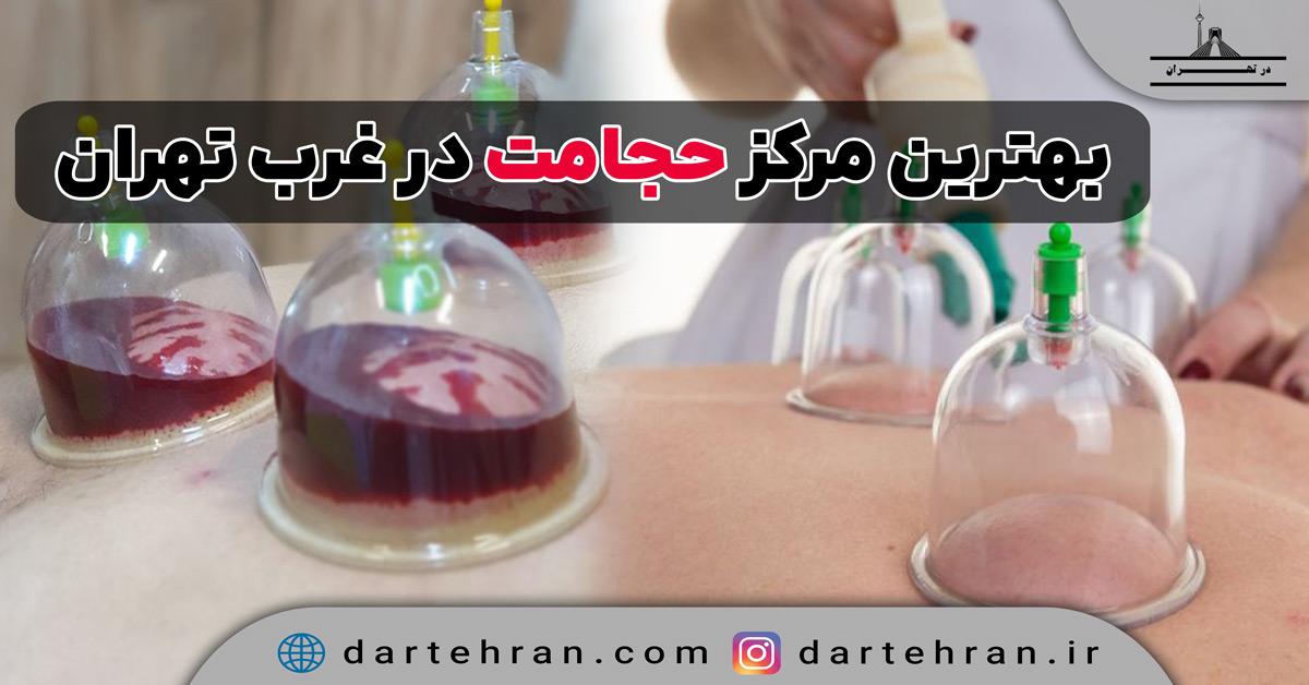 10 تا بهترین مرکز حجامت در غرب تهران (محیط بهداشتی) + تلفن بهترین مرکز حجامت در غرب تهران