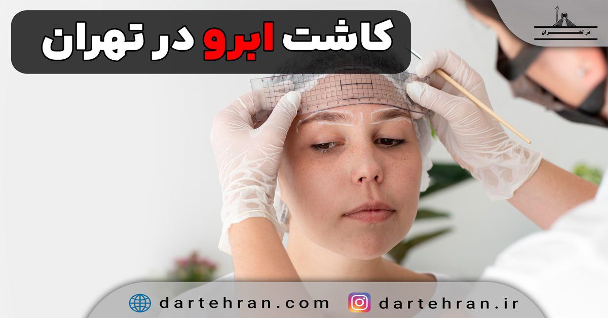 کاشت ابرو در تهران