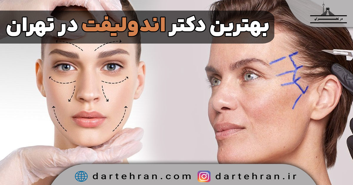 10 تا دکتر اندولیفت در تهران (بهترین متخصص) + لوکیشن و تلفن دکتر اندولیفت در تهران