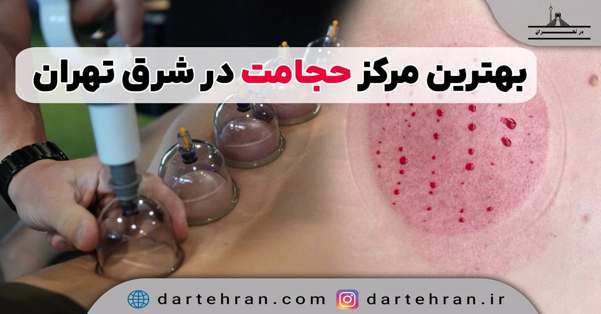 10 تا بهترین مراکز حجامت در شرق تهران (قیمت مناسب) + تلفن بهترین مراکز حجامت در شرق تهران