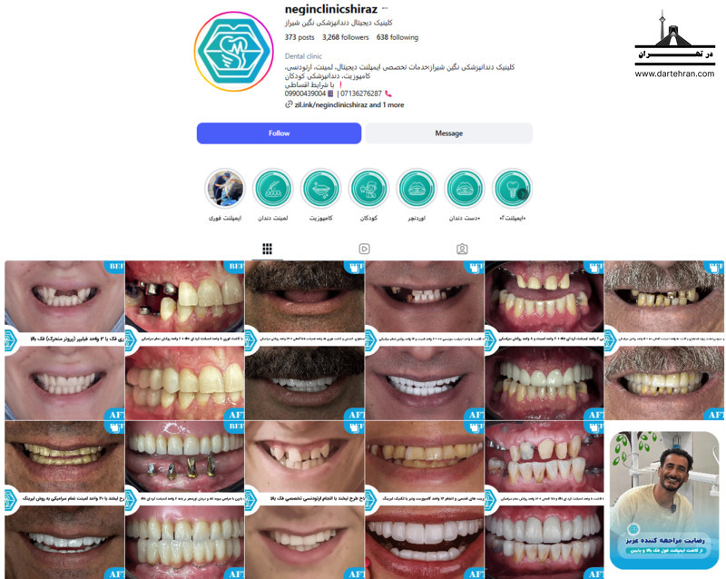 9 تا بهترین کلینیک دندانپزشکی در شیراز (طرف قرارداد بیمه) کلینیک دیجیتال دندانپزشکی نگین